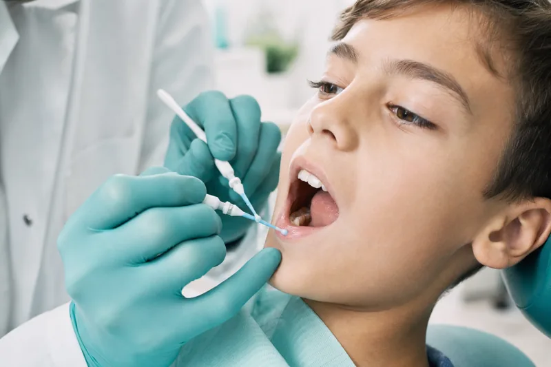 Dentist applying protective dental sealant to a child’s back molar