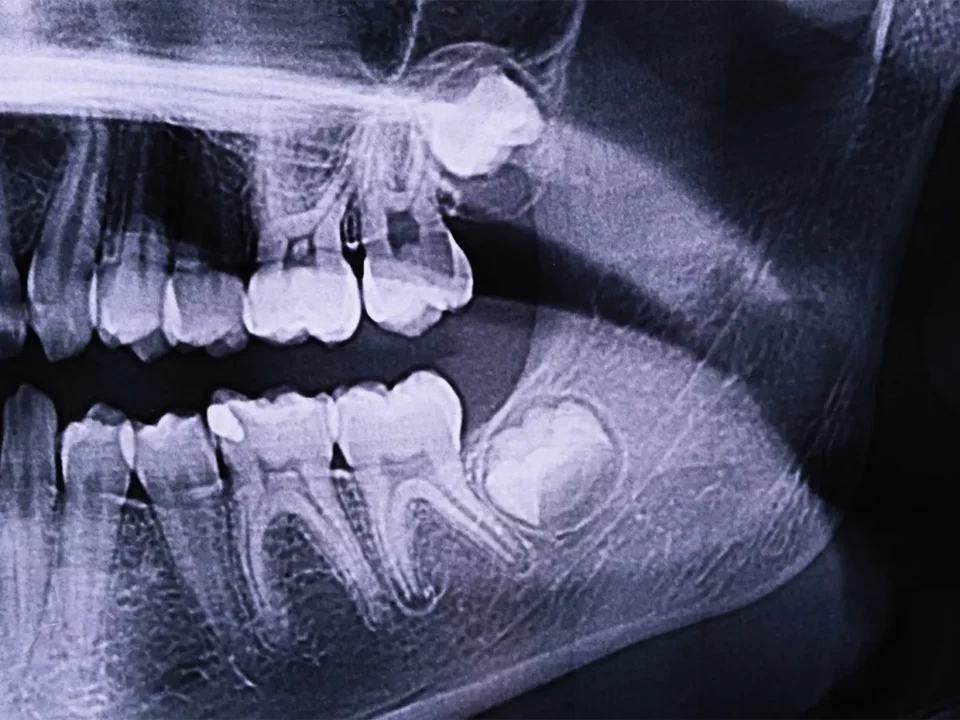 Gentle Dental Care serving communities across greater Houston