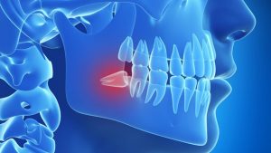 Trusted Oral Surgery Procedures