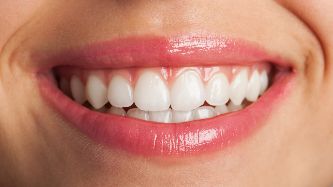 How to Achieve Your Ideal Smile Makeover by Combining Treatments