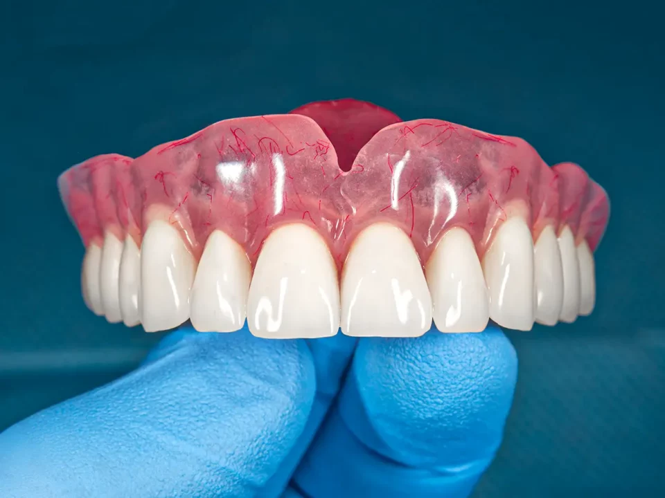 Tempting Dental Implant Near Me Magnolia, TX Choices